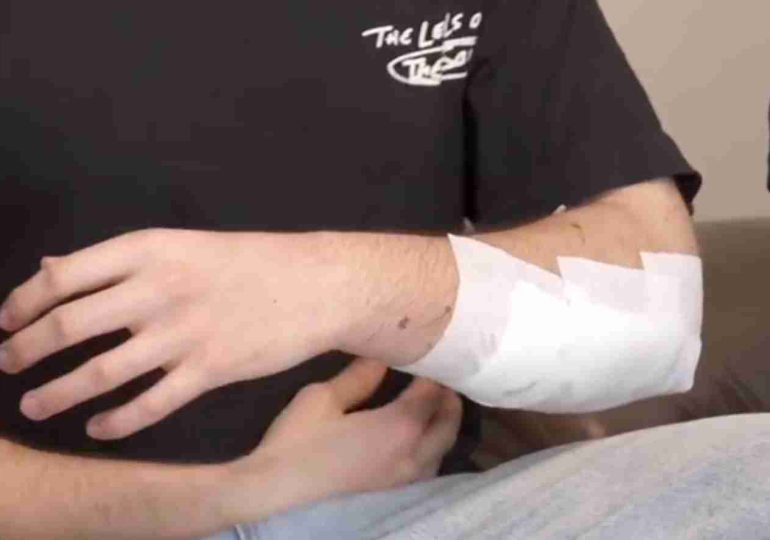 Tres jóvenes de Maldonado fueron asaltados en Parque Batlle; uno resultó gravemente herido tras ser apuñalado