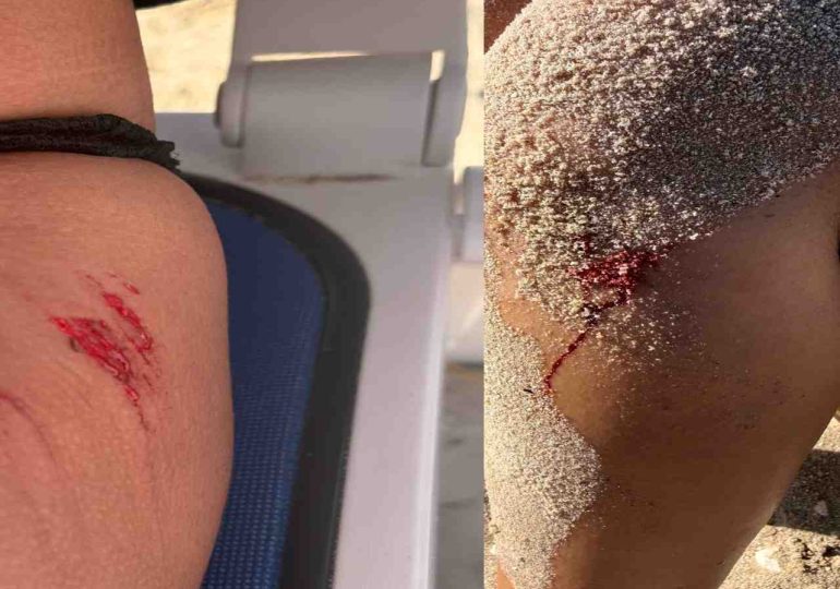Incidente con motos de agua dejó dos turistas lesionadas en Playa Mansa